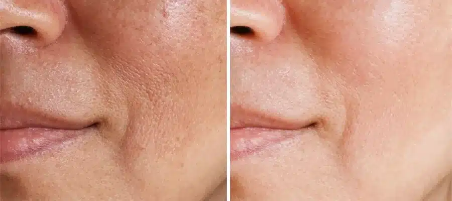 Are We Really Just a Few Drops Away from Reversing Aging