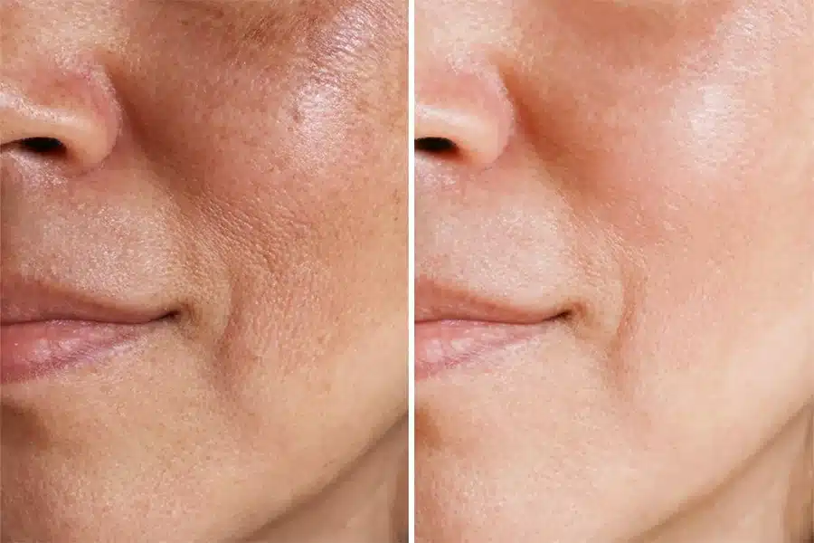 Are We Really Just a Few Drops Away from Reversing Aging?