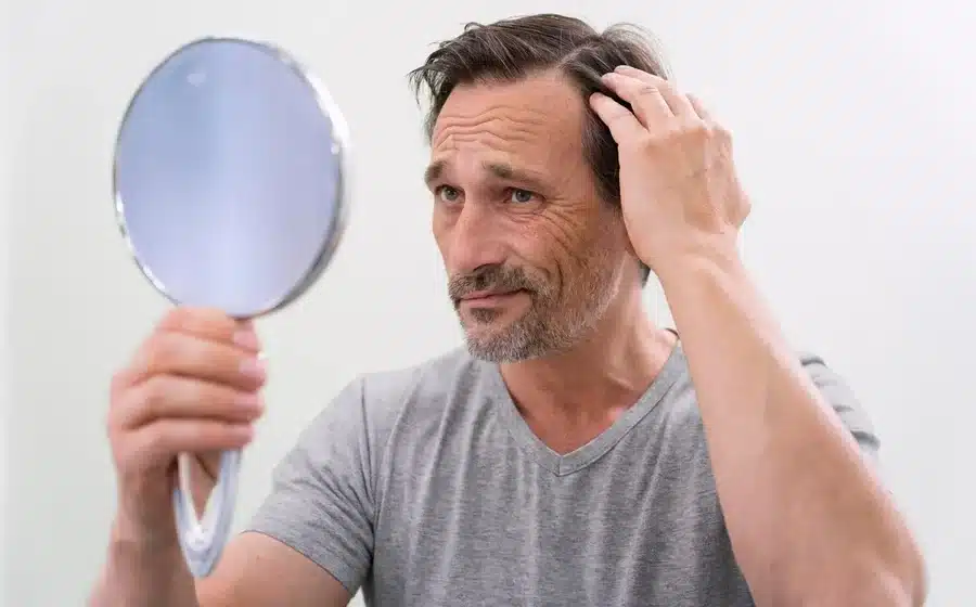 Hair Loss